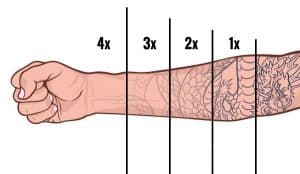 Eliminacion de tatuajes en Arcos de la Frontera